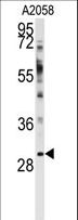 WBP2 Antibody - Western blot of anti-WBP2 Antibody in A2058 cell line lysates (35 ug/lane). WBP2 (arrow) was detected using the purified antibody.