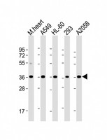WBP2 Antibody - All lanes: Anti-WBP2 Antibody (C-term) at 1:2000 dilution Lane 1: mouse heart lysate Lane 2: A549 whole cell lysate Lane 3: HL-60 whole cell lysate Lane 4: 293 whole cell lysate Lane 5: A2058 whole cell lysate Lysates/proteins at 20 µg per lane. Secondary Goat Anti-mouse IgG, (H+L), Peroxidase conjugated at 1/10000 dilution. Predicted band size: 28/32 kDa Blocking/Dilution buffer: 5% NFDM/TBST.