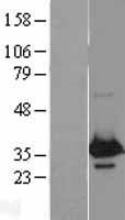 WBP2 Protein - Western validation with an anti-DDK antibody * L: Control HEK293 lysate R: Over-expression lysate