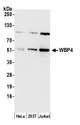 WBP4 Antibody - Detection of human WBP4 by western blot. Samples: Whole cell lysate (15 µg) from HeLa, HEK293T, and Jurkat cells prepared using NETN lysis buffer. Antibody: Affinity purified rabbit anti-WBP4 antibody used for WB at 1:1000. Detection: Chemiluminescence with an exposure time of 30 seconds.
