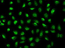 WBP4 Antibody - Immunofluorescence staining of WBP4 in U2OS cells. Cells were fixed with 4% PFA, permeabilzed with 0.3% Triton X-100 in PBS, blocked with 10% serum, and incubated with rabbit anti-Human WBP4 polyclonal antibody (dilution ratio 1:200) at 4°C overnight. Then cells were stained with the Alexa Fluor 488-conjugated Goat Anti-rabbit IgG secondary antibody (green). Positive staining was localized to Nucleus.