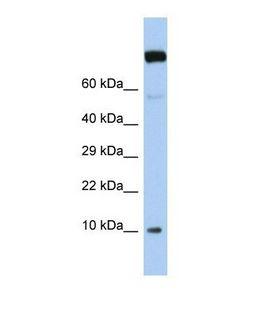 WBP5 Antibody - Western blot of Human Jurkat. WBP5 antibody dilution 1.0 ug/ml.  This image was taken for the unconjugated form of this product. Other forms have not been tested.