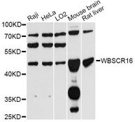WBSCR16 Antibody - Western blot analysis of extracts of various cell lines, using WBSCR16 antibody at 1:3000 dilution. The secondary antibody used was an HRP Goat Anti-Rabbit IgG (H+L) at 1:10000 dilution. Lysates were loaded 25ug per lane and 3% nonfat dry milk in TBST was used for blocking. An ECL Kit was used for detection and the exposure time was 30s.