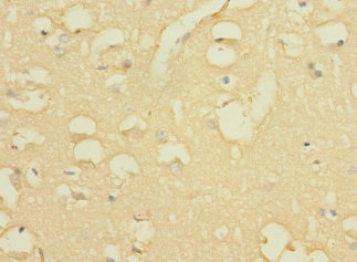 WBSCR17 Antibody - Immunohistochemistry of paraffin-embedded human brain tissue using WBSCR17 Antibody at dilution of 1:100