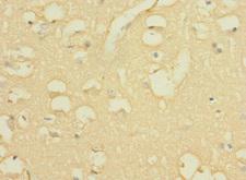 WBSCR17 Antibody - Immunohistochemistry of paraffin-embedded human brain tissue using WBSCR17 Antibody at dilution of 1:100