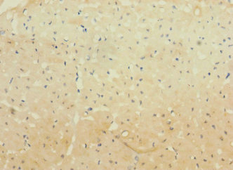 WBSCR17 Antibody - Immunohistochemistry of paraffin-embedded human heart tissue using WBSCR17 Antibody at dilution of 1:100