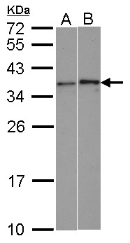 WBSCR22 Antibody - Sample (30 ug of whole cell lysate). A: HeLa, B: HCT116. 12% SDS PAGE. WBSCR22 antibody diluted at 1:1000.
