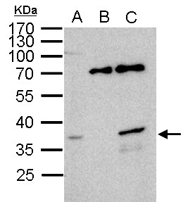 WBSCR22 Antibody - WBSCR22 antibody immunoprecipitates WBSCR22 protein in IP experiments. IP Sample:1000 ug HeLa whole cell lysate/extract A. 40 ug HeLa whole cell lysate/extract B. Control with 2.5 ug of preimmune rabbit IgG C. Immunoprecipitation of WBSCR22 protein by 2.5 ug of WBSCR22 antibody 12% SDS-PAGE The immunoprecipitated WBSCR22 protein was detected by WBSCR22 antibody diluted at 1:1000. EasyBlot anti-rabbit IgG (anti-rabbit IgG (HRP) -01) was used as a secondary reagent.