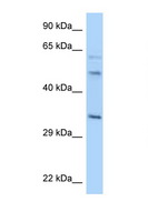 WBSCR22 Antibody - WBSCR22 antibody Western blot of 8226 Cell lysate. Antibody concentration 1 ug/ml.  This image was taken for the unconjugated form of this product. Other forms have not been tested.
