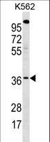 WBSCR22 Antibody - WBSCR22 Antibody western blot of K562 cell line lysates (35 ug/lane). The WBSCR22 antibody detected the WBSCR22 protein (arrow).