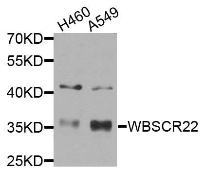 WBSCR22 Antibody - Western blot analysis of extracts of various cells.