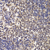 WBSCR22 Antibody - Immunohistochemistry of paraffin-embedded rat spleen tissue.