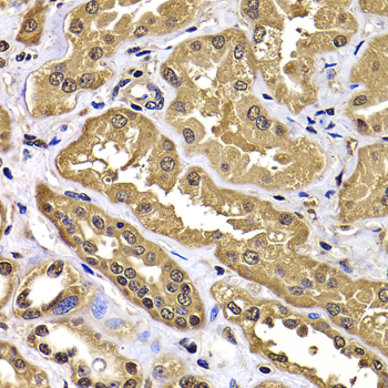 WBSCR22 Antibody - Immunohistochemistry of paraffin-embedded human kidney tissue.