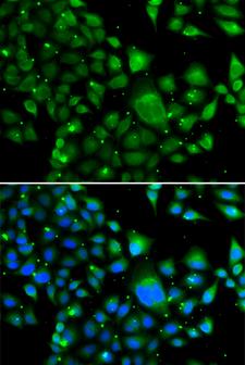 WBSCR22 Antibody - Immunofluorescence analysis of MCF7 cells.