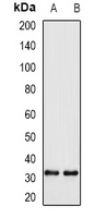 WBSCR22 Antibody - Western blot analysis of WBSCR22 expression in H460 (A); A549 (B) whole cell lysates.