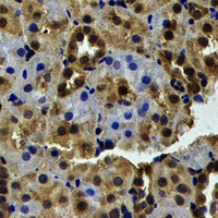 WBSCR22 Antibody - Immunohistochemical analysis of WBSCR22 staining in human kidney formalin fixed paraffin embedded tissue section. The section was pre-treated using heat mediated antigen retrieval with sodium citrate buffer (pH 6.0). The section was then incubated with the antibody at room temperature and detected using an HRP conjugated compact polymer system. DAB was used as the chromogen. The section was then counterstained with hematoxylin and mounted with DPX.