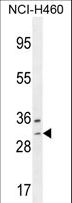 WBSCR27 Antibody - WBSCR27 Antibody western blot of NCI-H460 cell line lysates (35 ug/lane). The WBSCR27 antibody detected the WBSCR27 protein (arrow).