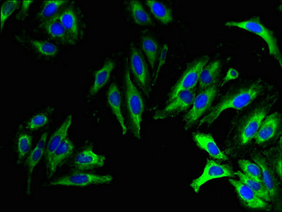 WBSCR28 Antibody - Immunofluorescent analysis of Hela cells using WBSCR28 Antibody at dilution of 1:100 and Alexa Fluor 488-congugated AffiniPure Goat Anti-Rabbit IgG(H+L)