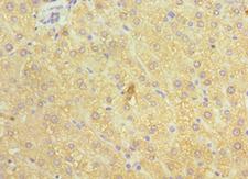 WC1 / ATP7B Antibody - Immunohistochemistry of paraffin-embedded human liver using antibody 1:100 dilution.