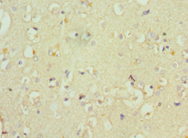 WC1 / ATP7B Antibody - Immunohistochemistry of paraffin-embedded human brain using antibody 1:100 dilution.