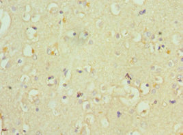 WC1 / ATP7B Antibody - Immunohistochemistry of paraffin-embedded human brain tissue using ATP7B Antibody at dilution of 1:100
