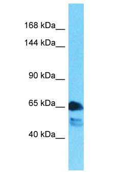 WC1 / ATP7B Antibody - WC1 / ATP7B antibody Western Blot of Lung Tumor. Antibody dilution: 1 ug/ml.  This image was taken for the unconjugated form of this product. Other forms have not been tested.