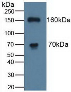 WC1 / ATP7B Antibody - Western Blot; Sample: Human K562 Cells.