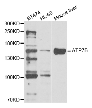 WC1 / ATP7B Antibody - Western blot analysis of extracts of various cell lines.
