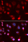 WC1 / ATP7B Antibody - Immunofluorescence analysis of U20S cells.