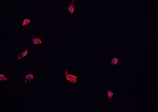 WC1 / ATP7B Antibody - Staining CACO-2 cells by IF/ICC. The samples were fixed with PFA and permeabilized in 0.1% Triton X-100, then blocked in 10% serum for 45 min at 25°C. The primary antibody was diluted at 1:200 and incubated with the sample for 1 hour at 37°C. An Alexa Fluor 594 conjugated goat anti-rabbit IgG (H+L) antibody, diluted at 1/600, was used as secondary antibody.