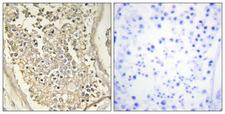 WC1 / ATP7B Antibody - Peptide - + Immunohistochemistry analysis of paraffin-embedded human testis tissue, using ATP7B antibody.