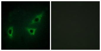 WC1 / ATP7B Antibody - Peptide - + Immunofluorescence analysis of HeLa cells, using ATP7B antibody.