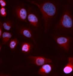 WC1 / ATP7B Antibody - Immunofluorescence analysis of U2OS cells using ATP7B antibody. Blue: DAPI for nuclear staining.