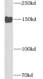 WC1 / ATP7B Antibody - Mouse liver tissue were subjected to SDS PAGE followed by western blot with ATP7B antibody at dilution of 1:1000