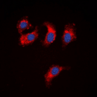 WC1 / ATP7B Antibody - Immunofluorescent analysis of ATP7B staining in HepG2 cells. Formalin-fixed cells were permeabilized with 0.1% Triton X-100 in TBS for 5-10 minutes and blocked with 3% BSA-PBS for 30 minutes at room temperature. Cells were probed with the primary antibody in 3% BSA-PBS and incubated overnight at 4 ??C in a humidified chamber. Cells were washed with PBST and incubated with a DyLight 594-conjugated secondary antibody (red) in PBS at room temperature in the dark. DAPI was used to stain the cell nuclei (blue).