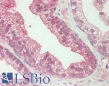 WDFY1 Antibody - Human Prostate: Formalin-Fixed, Paraffin-Embedded (FFPE).  This image was taken for the unconjugated form of this product. Other forms have not been tested.