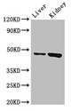 WDFY1 Antibody - Positive WB detected in:Mouse liver tissue,Mouse kidney tissue;All lanes:WDFY1 antibody at 3ug/ml;Secondary;Goat polyclonal to rabbit IgG at 1/50000 dilution;Predicted band size: 47 kDa;Observed band size: 47 kDa;