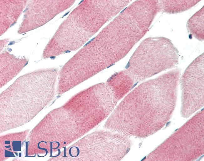 WDFY1 Antibody - Human Skeletal Muscle: Formalin-Fixed, Paraffin-Embedded (FFPE).  This image was taken for the unconjugated form of this product. Other forms have not been tested.
