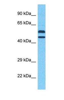 WDFY2 Antibody - Western blot of WDFY2 Antibody with human MCF7 Whole Cell lysate.  This image was taken for the unconjugated form of this product. Other forms have not been tested.