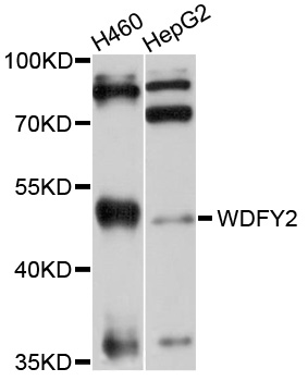 WDFY2 Antibody - Western blot analysis of extracts of various cell lines, using WDFY2 antibody at 1:1000 dilution. The secondary antibody used was an HRP Goat Anti-Rabbit IgG (H+L) at 1:10000 dilution. Lysates were loaded 25ug per lane and 3% nonfat dry milk in TBST was used for blocking. An ECL Kit was used for detection and the exposure time was 30s.