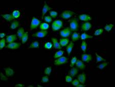 WDFY2 Antibody - Immunofluorescence staining of Hela cells diluted at 1:66, counter-stained with DAPI. The cells were fixed in 4% formaldehyde, permeabilized using 0.2% Triton X-100 and blocked in 10% normal Goat Serum. The cells were then incubated with the antibody overnight at 4°C.The Secondary antibody was Alexa Fluor 488-congugated AffiniPure Goat Anti-Rabbit IgG (H+L).