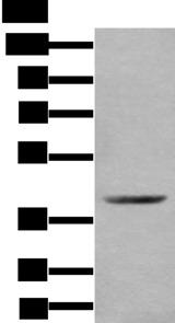 WDFY2 Antibody - Western blot analysis of Mouse kidney tissue lysate  using WDFY2 Polyclonal Antibody at dilution of 1:350
