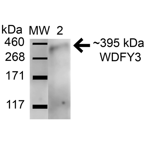 WDFY3 / ALFY Antibody - Western blot analysis of Rat brain showing detection of 395.2 kDa WDFY3 protein using Rabbit Anti-WDFY3 Polyclonal Antibody. Lane 1: Molecular Weight Ladder (MW). Lane 2: Rat Brain. Load: 15 µg. Block: 5% Skim Milk in 1X TBST. Primary Antibody: Rabbit Anti-WDFY3 Polyclonal Antibody  at 1:1000 for 1 hour at RT. Secondary Antibody: Goat Anti-Rabbit HRP at 1:2000 for 60 min at RT. Color Development: ECL solution for 6 min in RT. Predicted/Observed Size: 395.2 kDa.