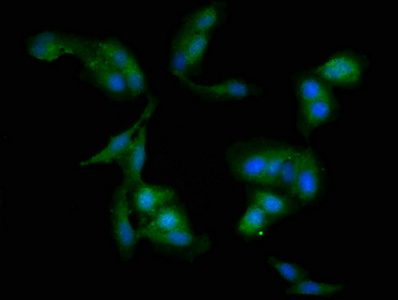 WDFY3 / ALFY Antibody - Immunofluorescent analysis of Hela cells at a dilution of 1:100 and Alexa Fluor 488-congugated AffiniPure Goat Anti-Rabbit IgG(H+L)