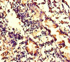 WDFY4 Antibody - Immunohistochemistry of paraffin-embedded human appendix tissue at dilution of 1:100