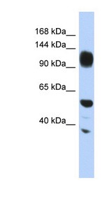 WDHD1 Antibody - WDHD1 antibody Western blot of HepG2 cell lysate. This image was taken for the unconjugated form of this product. Other forms have not been tested.
