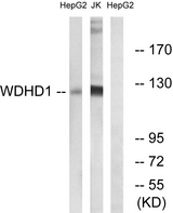 WDHD1 Antibody - Western blot analysis of lysates from Jurkat and HepG2 cells, using WDHD1 Antibody. The lane on the right is blocked with the synthesized peptide.