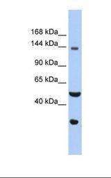 WDHD1 Antibody - Hela cell lysate. Antibody concentration: 1.0 ug/ml. Gel concentration: 6-18%.  This image was taken for the unconjugated form of this product. Other forms have not been tested.