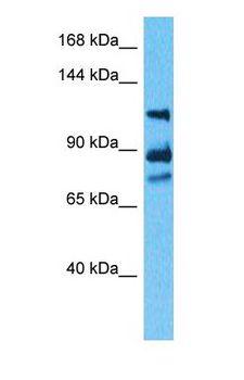WDHD1 Antibody - Western blot of WDHD1 Antibody with human 293T Whole Cell lysate.  This image was taken for the unconjugated form of this product. Other forms have not been tested.
