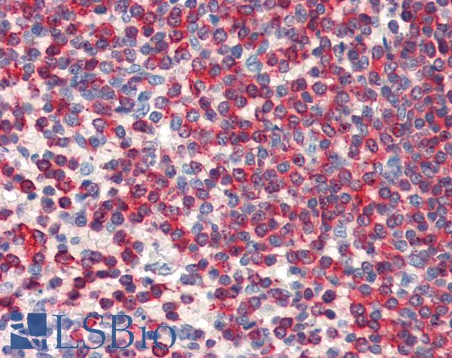 WDHD1 Antibody - Anti-WDHD1 antibody IHC of human spleen. Immunohistochemistry of formalin-fixed, paraffin-embedded tissue after heat-induced antigen retrieval. Antibody concentration 5 ug/ml.  This image was taken for the unconjugated form of this product. Other forms have not been tested.